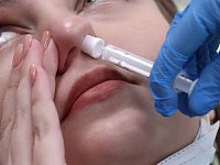 Жители Ивановки привились от коронавируса новым способом